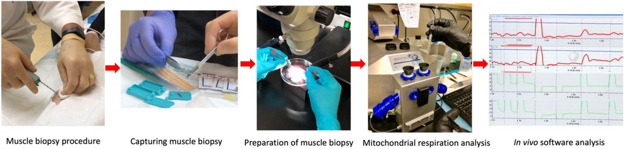 Muscle Biopsy—Mitochondrial Extraction