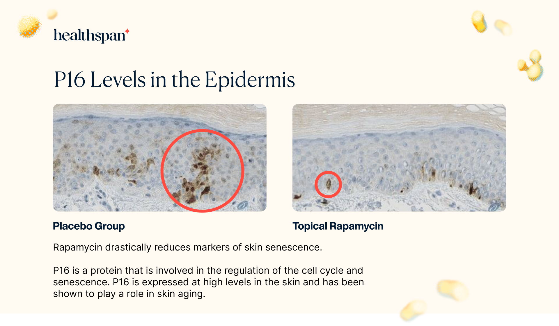 p16 Levels in Epidermis After Rapamycin
