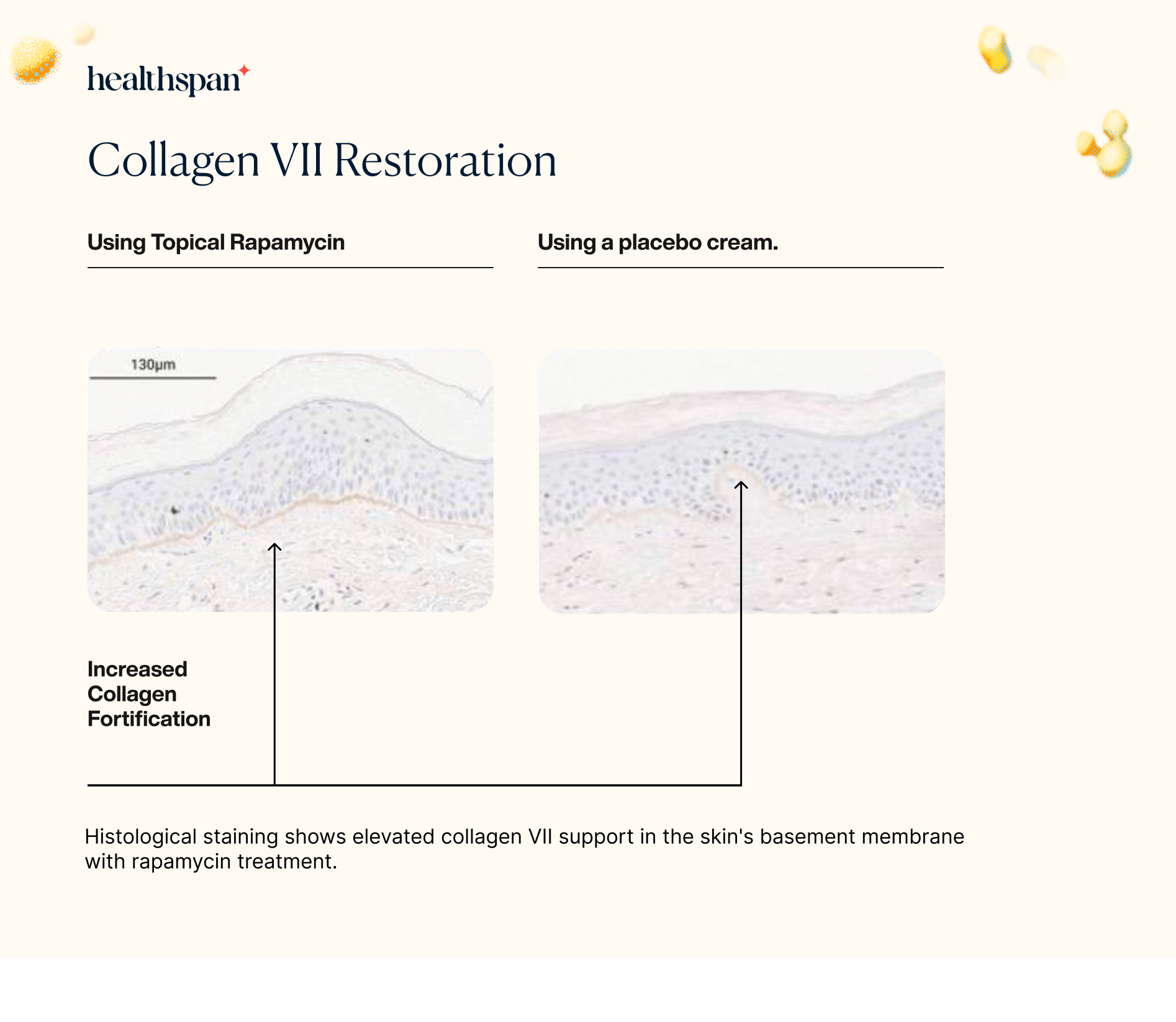 Rapamycin Colagen VII restoration