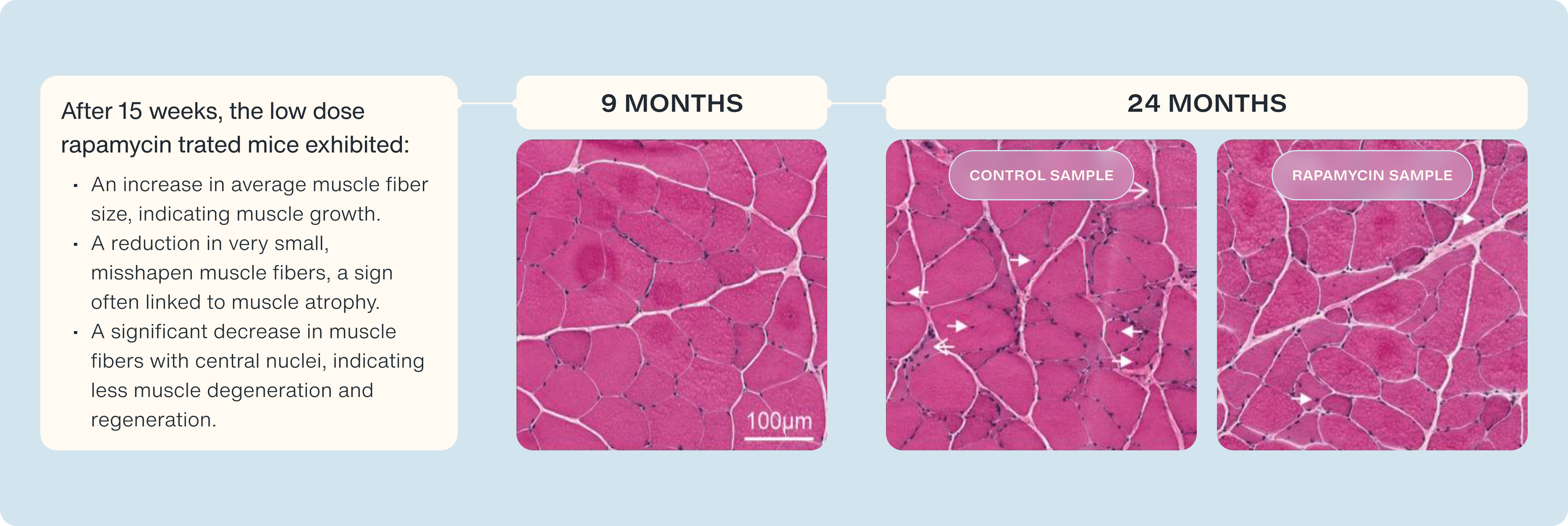 Rapamycin and Muscle Growth
