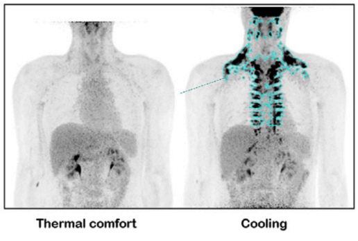 Thermogenesis & Brown Tissue Activation