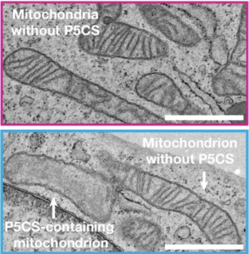 Functionally Distinct Mitochondria