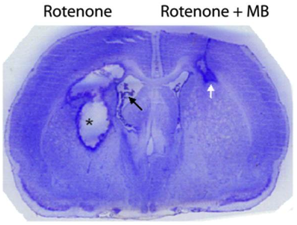 Neuroprotection with methylene blue.