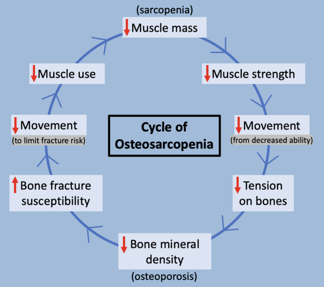 A cycle of osteosarcopenia