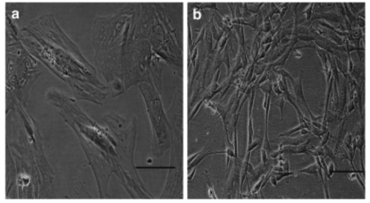 Senescent DPC fibroblasts