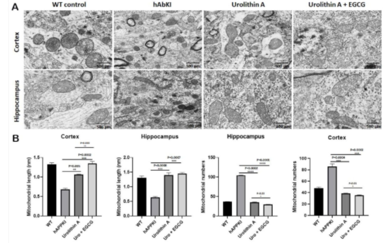 Mitochondrial morphology and quantification in brain regions under experimental drug treatments.