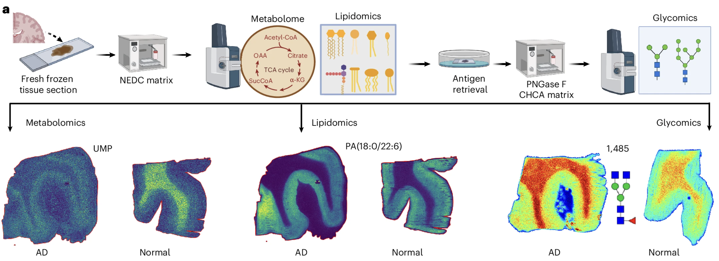 Multi-omics workflow compares metabolites, lipids, and glycans in AD versus normal tissue sections.