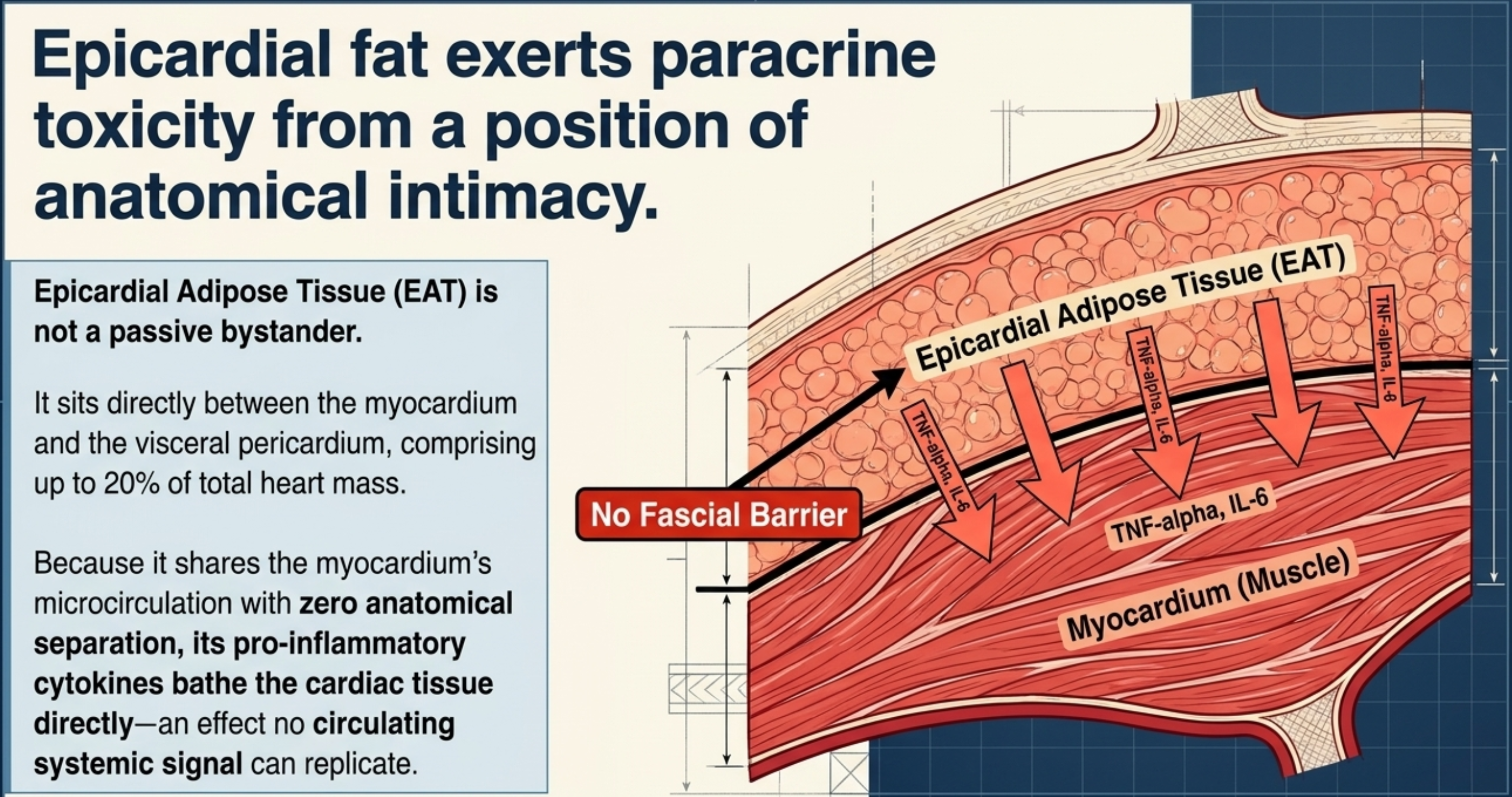 Diagram illustrating epicardial fat's direct paracrine toxicity on myocardium due to no fascial barrier.
