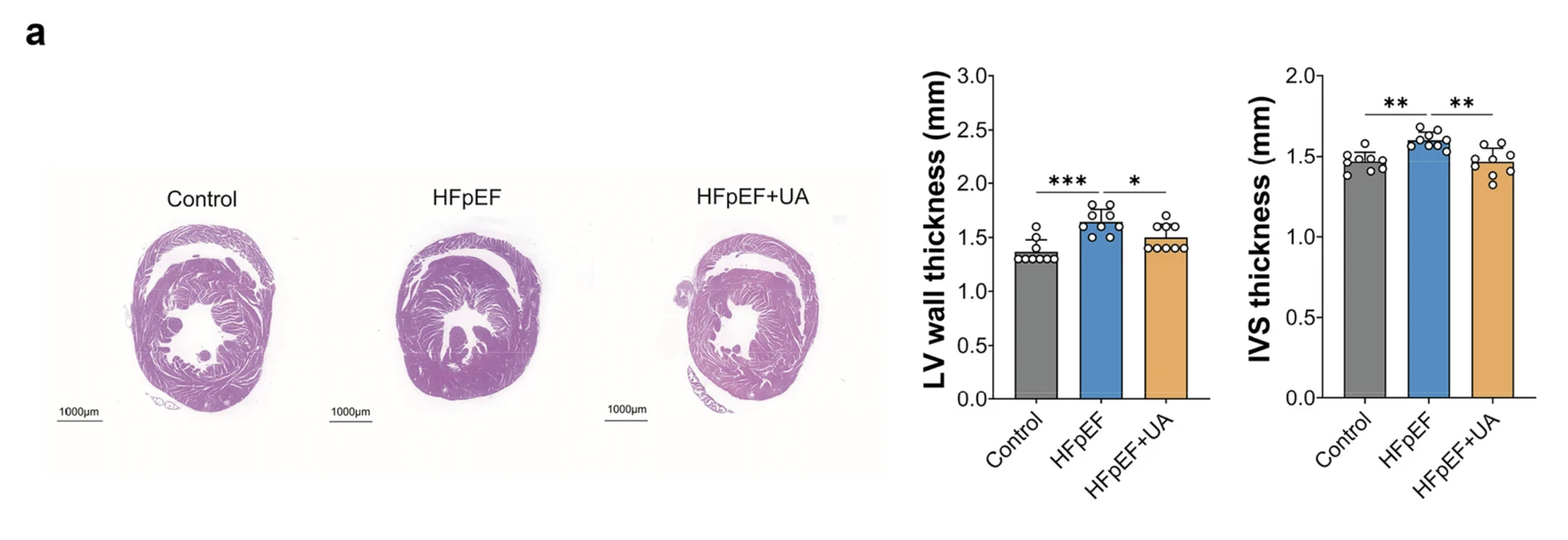 Cardiac histology and bar graphs demonstrate left ventricular and interventricular septum thickness measurements.
