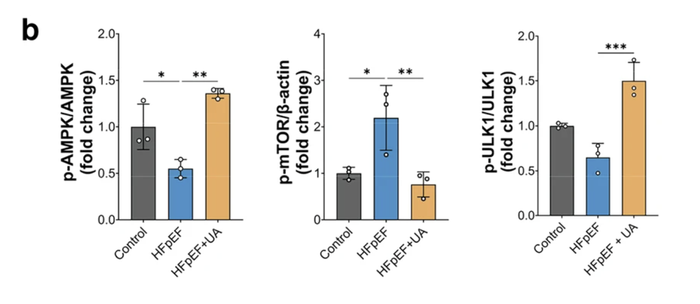 Bar graphs display phosphorylation ratios of AMPK, mTOR, and ULK1 under control, HFpEF, and UA treatment.