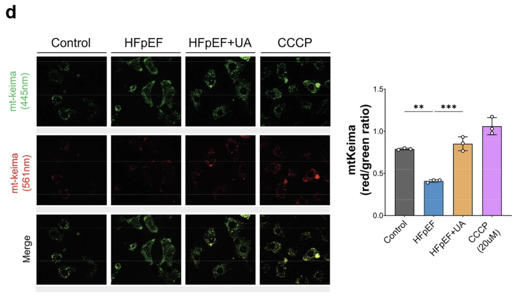 Mitochondrial fluorescence images and bar graph show mtKeima red/green ratio in different conditions.