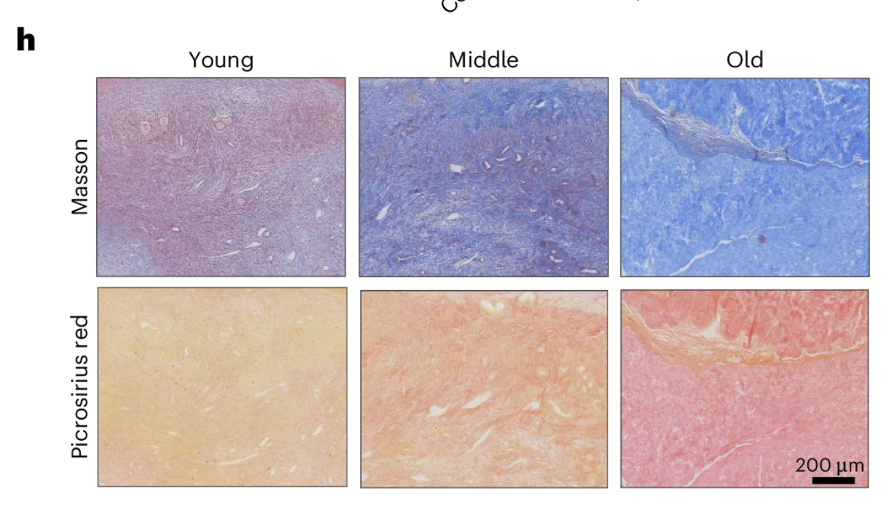 Histological sections stained with Masson and Picrosirius red reveal age-dependent tissue changes.